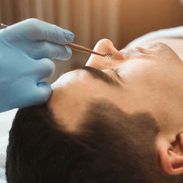 Blackhead Removal