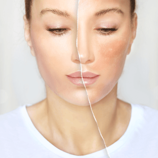 Brightening Facial