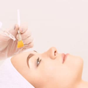 Chemical Peel