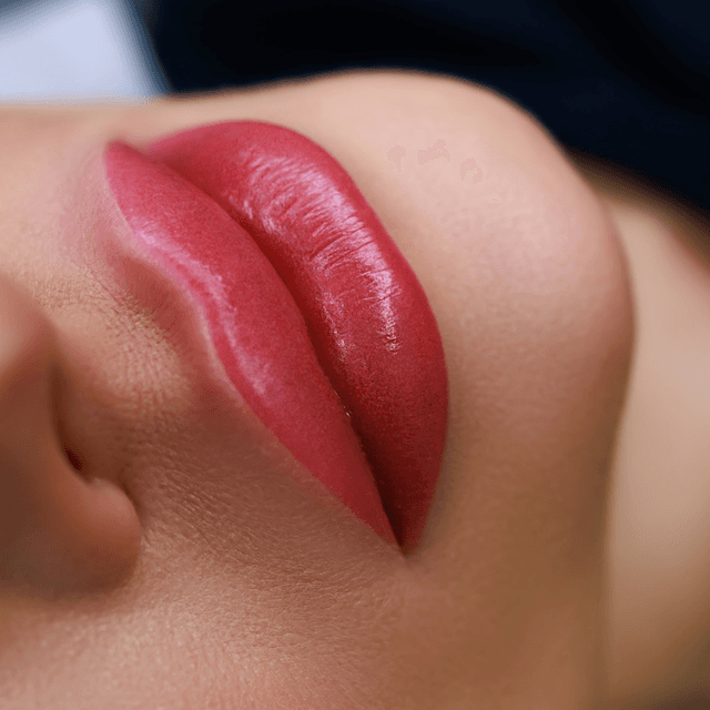 Lip Fillers & Enhancements 