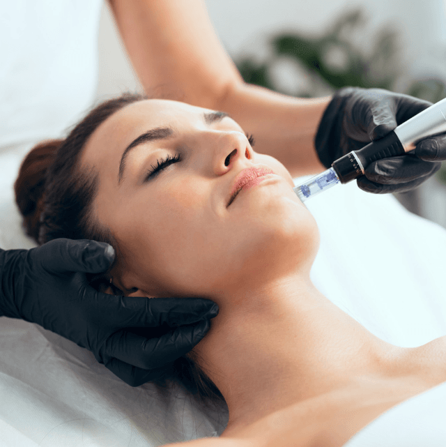 Microneedling