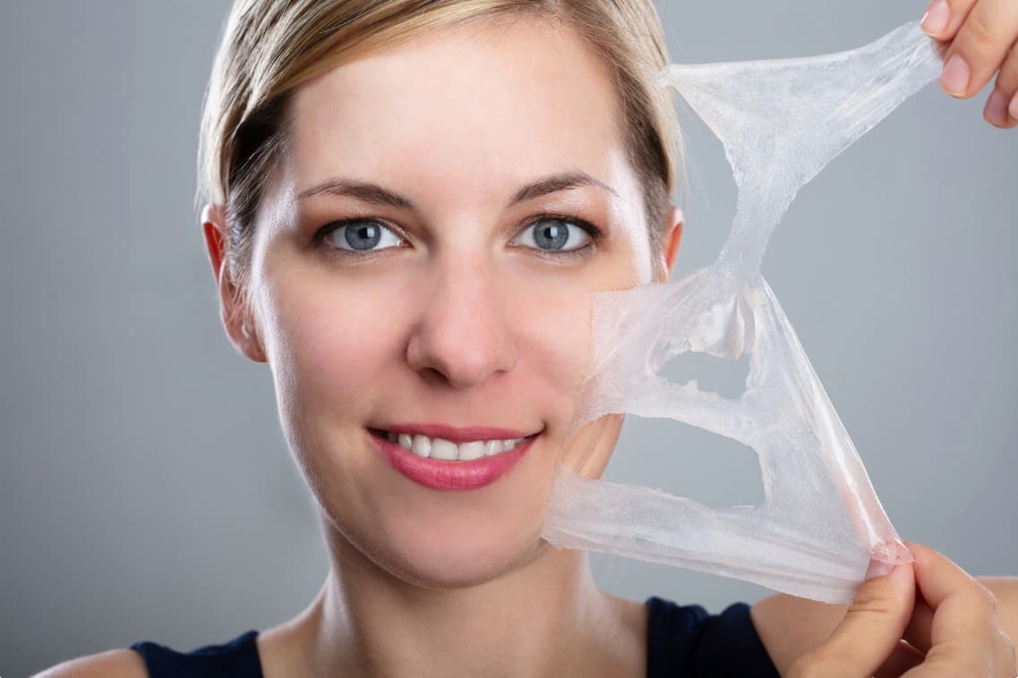 Chemical Peels