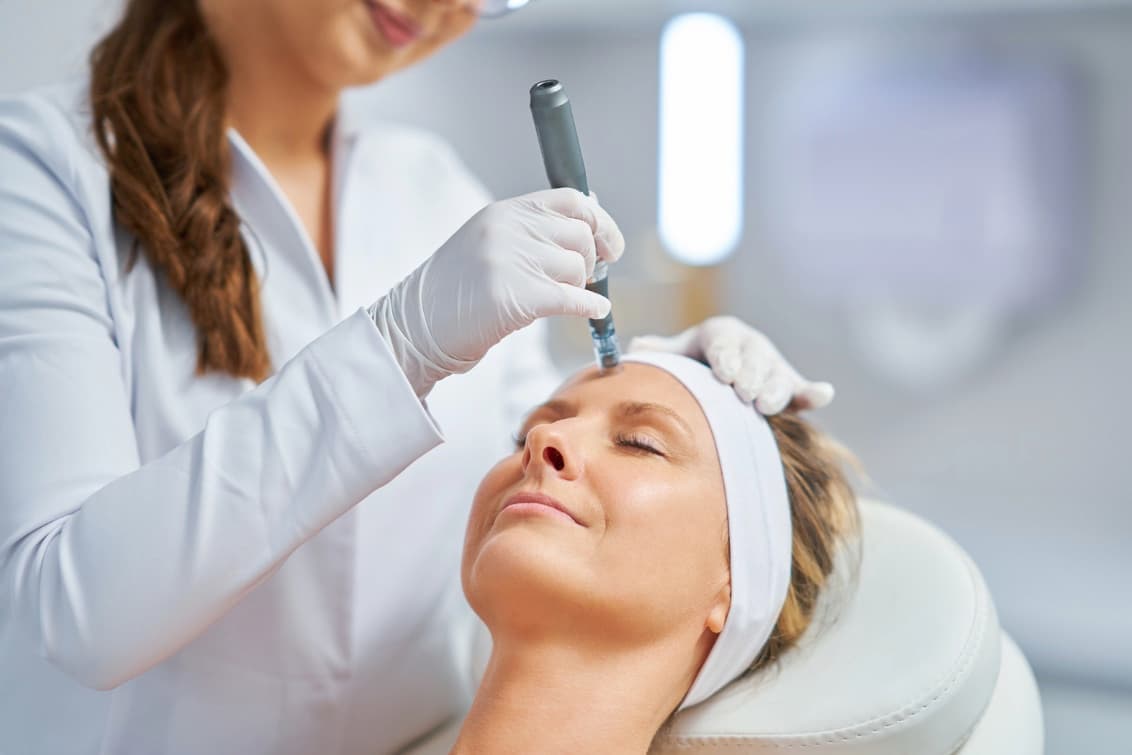 Microneedling and Morpheus8